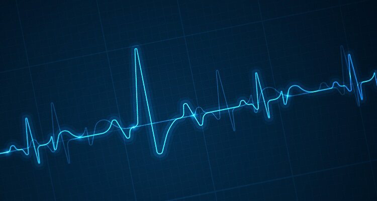 Heartbeat monitor